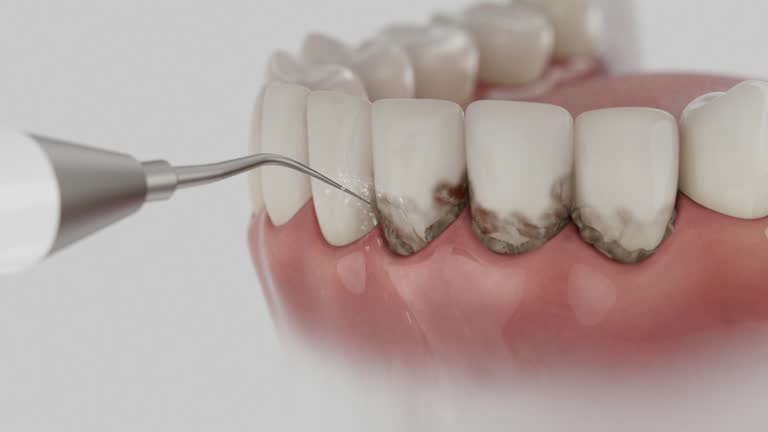 Trusted Dental Crowns And Bridges service in Three Way, TN - Dentist Open Now